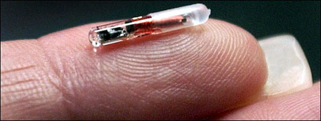 Archived image: implant
